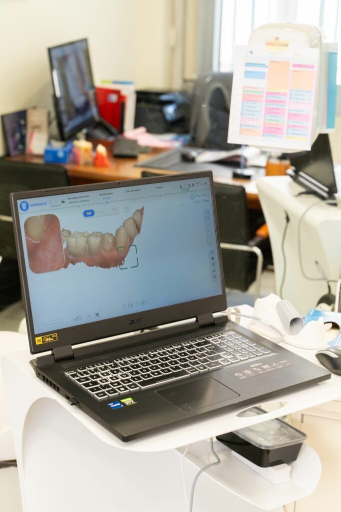 Empreinte optique numérique 3D au cabinet dentaire d'Athis-Mons