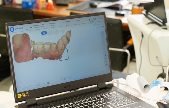 Empreinte optique numérique 3D au cabinet dentaire d'Athis-Mons